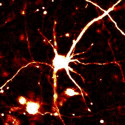 Animated neuron visualization from SUI Health research